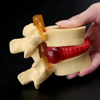 Медицински реквизит модел Безплатни пощенски разходи Анатомичен гръбначен стълб Лумбална дискова херния Анатомия Медицински инструмент за преподаване